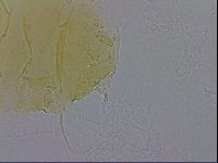 Echiniscus trisetosus image