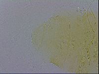 Echiniscus trisetosus image