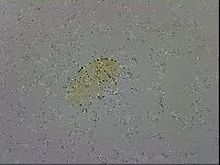 Echiniscus trisetosus image