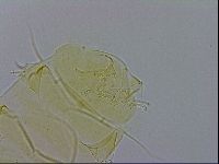 Echiniscus trisetosus image