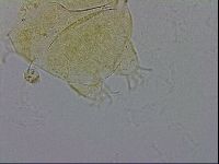 Echiniscus trisetosus image