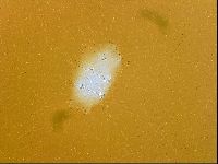 Echiniscus trisetosus image