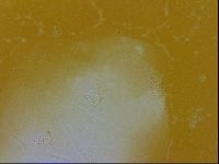 Echiniscus trisetosus image