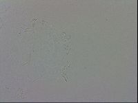 Echiniscus trisetosus image