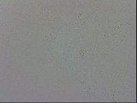 Echiniscus trisetosus image