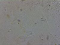 Echiniscus trisetosus image