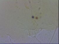Echiniscus trisetosus image