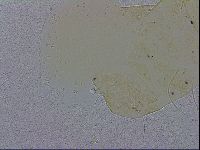 Echiniscus trisetosus image