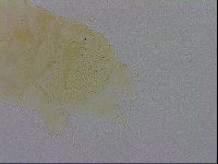 Echiniscus trisetosus image