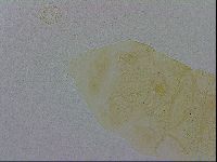 Echiniscus trisetosus image