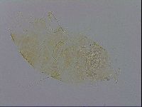 Echiniscus trisetosus image