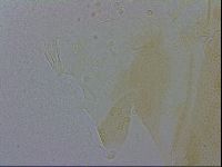 Echiniscus trisetosus image