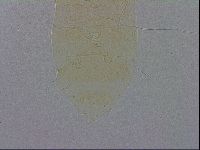 Echiniscus trisetosus image