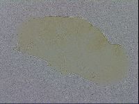 Echiniscus trisetosus image