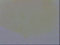 Echiniscus trisetosus image