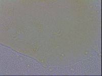 Echiniscus trisetosus image