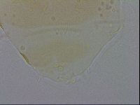Echiniscus trisetosus image