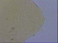 Echiniscus trisetosus image