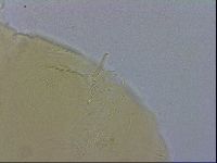 Echiniscus trisetosus image