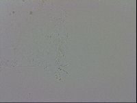 Echiniscus trisetosus image