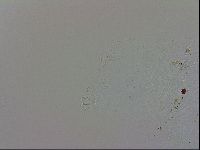 Echiniscus trisetosus image
