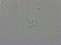 Echiniscus trisetosus image