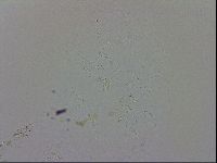 Echiniscus trisetosus image