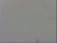 Echiniscus trisetosus image
