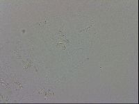 Echiniscus trisetosus image