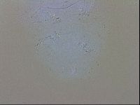 Echiniscus trisetosus image