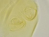 Echiniscus trisetosus image