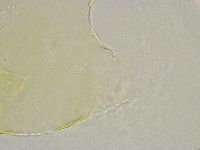 Echiniscus trisetosus image