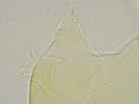 Echiniscus trisetosus image