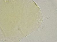 Echiniscus trisetosus image
