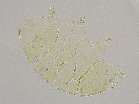 Echiniscus trisetosus image