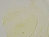 Echiniscus trisetosus image