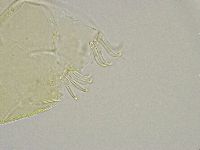 Echiniscus trisetosus image