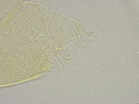 Echiniscus trisetosus image