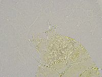 Echiniscus trisetosus image