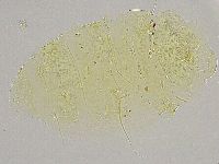 Echiniscus trisetosus image