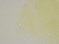 Echiniscus trisetosus image