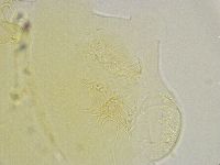 Echiniscus trisetosus image