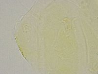 Echiniscus trisetosus image
