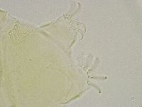 Echiniscus trisetosus image