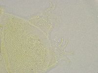 Echiniscus trisetosus image