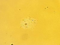 Echiniscus trisetosus image