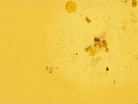 Echiniscus trisetosus image