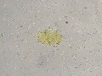 Echiniscus trisetosus image