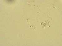 Echiniscus trisetosus image