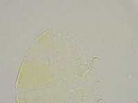 Echiniscus trisetosus image